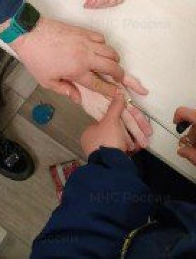 сняли кольцоэ