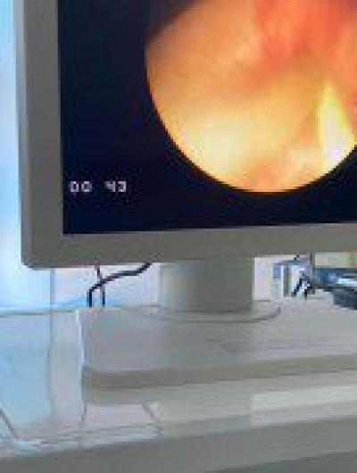 В Ливнах применяют инновационный способ лечения мочекаменной болезни 1