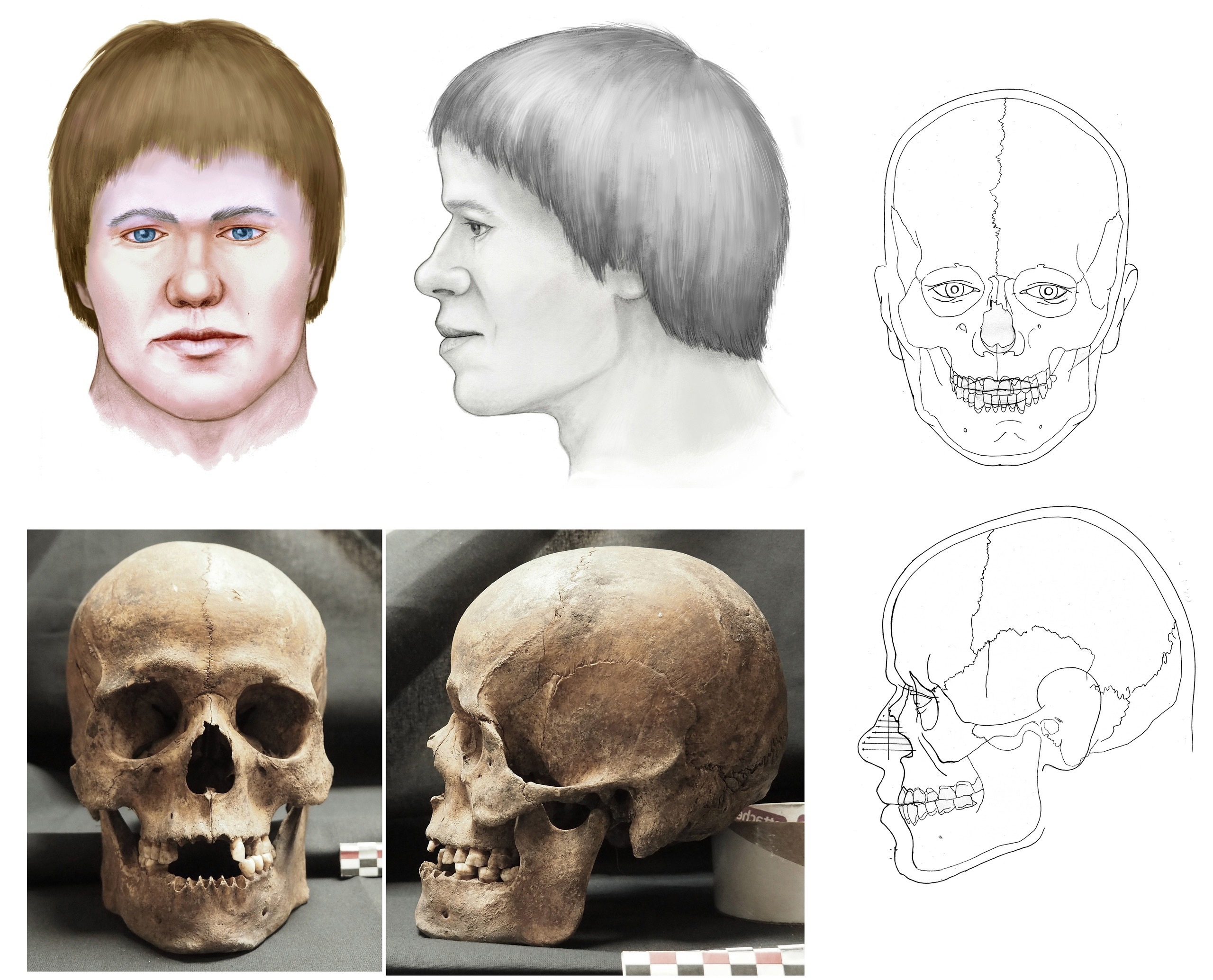 Сущность реконструкции. Реконструкция по черепу. Графическая реконструкция лица по черепу. Восстановление лица по черепу. Восстановление облика по черепу.