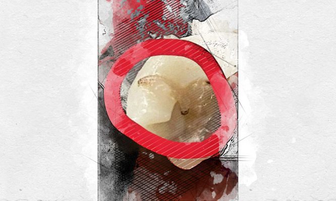 В Орловской области червяк в тарелке вскрыл многолетние проблемы школьной столовой